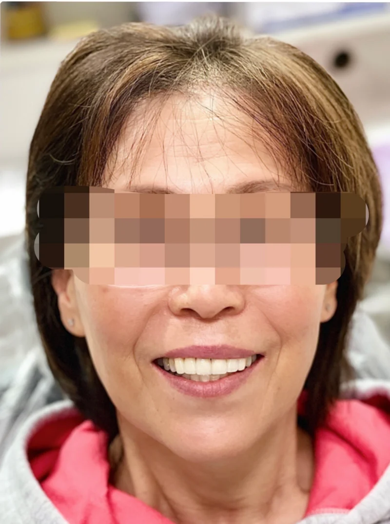 After treatment: Cosmetic Dentistry patient at Premier Dental