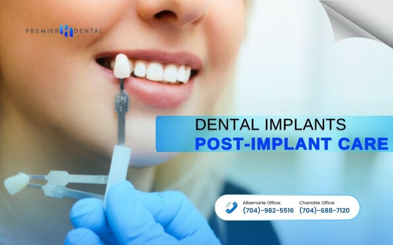 Implant DentistryPost-Implant Care