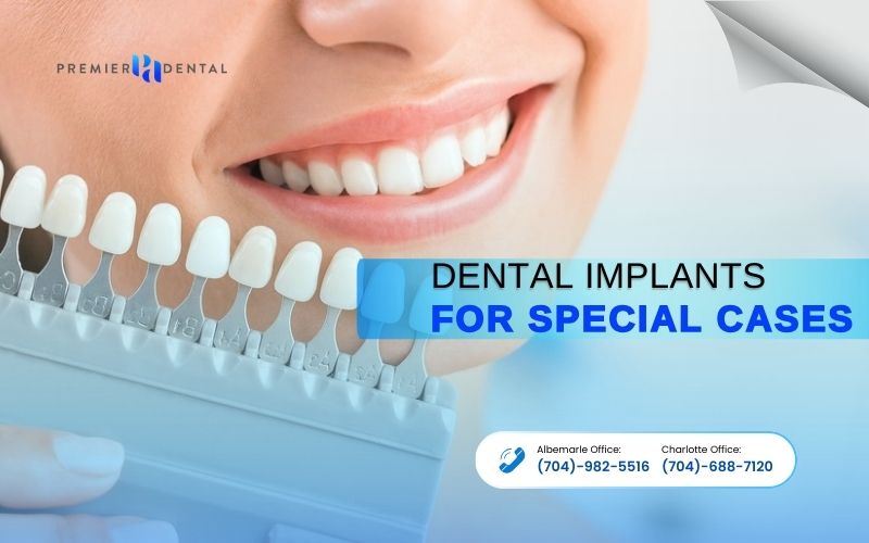 Implant DentistryDental Implants for Special Cases