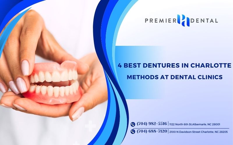 Top 4 Best Dentures in Charlotte Methods at Dental Clinics Today