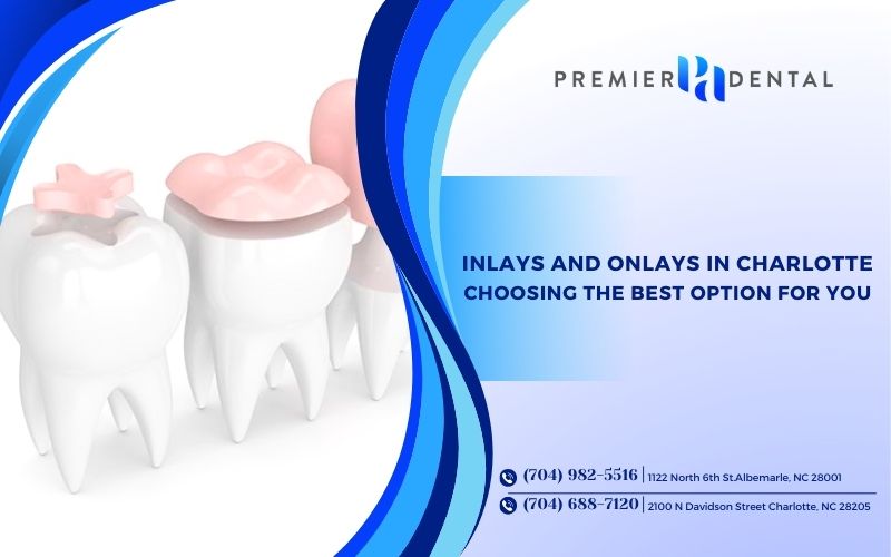 Inlays and Onlays in Charlotte: Choosing the Best Option for You