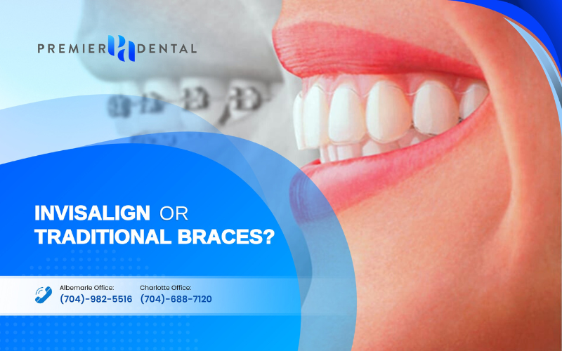 Invisalign Dentistry in Charlotte Invisalign or traditional braces?