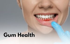 candidate for Dental Implants in CharlotteGum Health