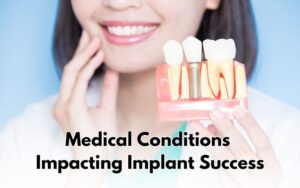 candidate for Dental Implants in CharlotteMedical Conditions Impacting Implant Success