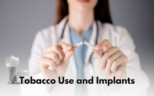 candidate for Dental Implants in CharlotteTobacco Use and Implants
