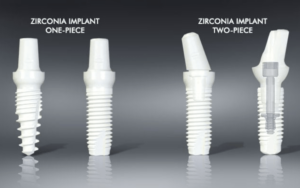 Implant Materials in CharlotteZirconia Implants
