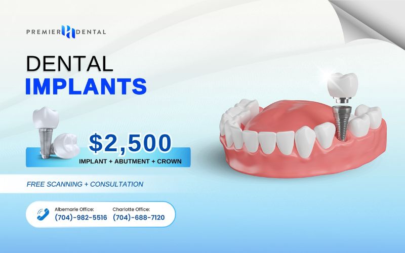 Implant DentistryExclusive Implant Promotions at Premier Dental