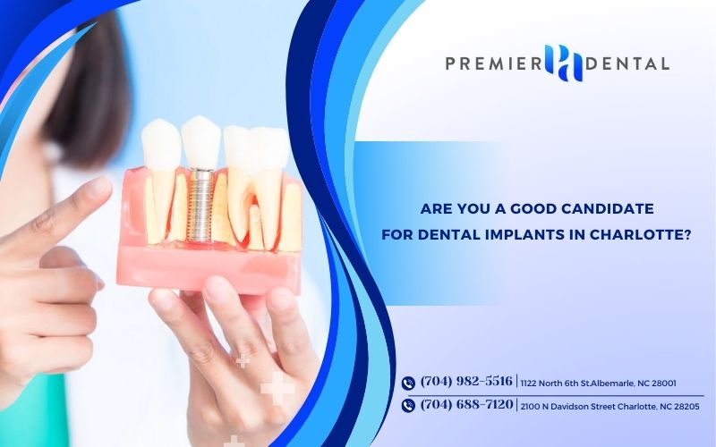 Are You a Good Candidate for Dental Implants in Charlotte?
