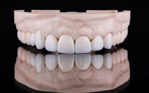 Full mouth restoration in CharlotteCost of Full Mouth Reconstruction in Charlotte