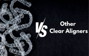 Overview of Invisalign in CharlotteInvisalign vs. other Clear Aligners