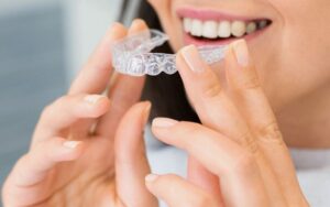 Overview of Invisalign in CharlotteHow Invisalign Works?