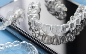 Overview of Invisalign in CharlotteThe popularity of Invisalign in Charlotte