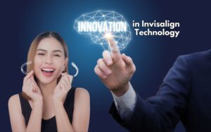Overview of Invisalign in CharlotteInnovations in Invisalign Technology