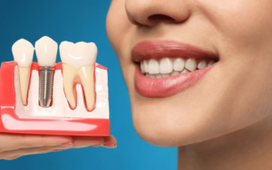 Benefits of Dental ImplantsAesthetic Benefits