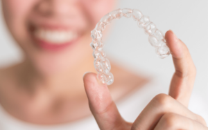 Suitability and Eligibility in CharlotteIdeal Candidates for Invisalign