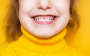 Suitability and Eligibility in CharlotteInvisalign for Severe Orthodontic Cases