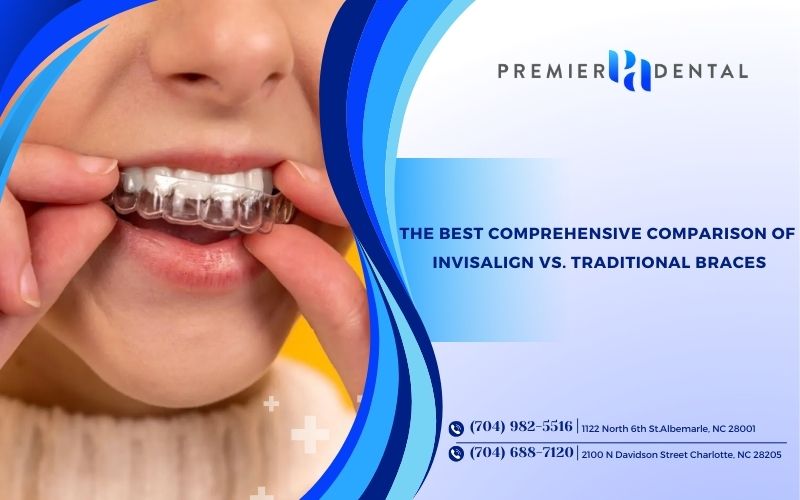 The Best Comprehensive Comparison of Invisalign vs. Traditional Braces