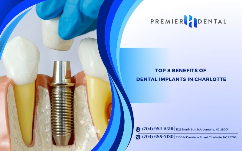 Top 8 Benefits of Dental Implants in Charlotte