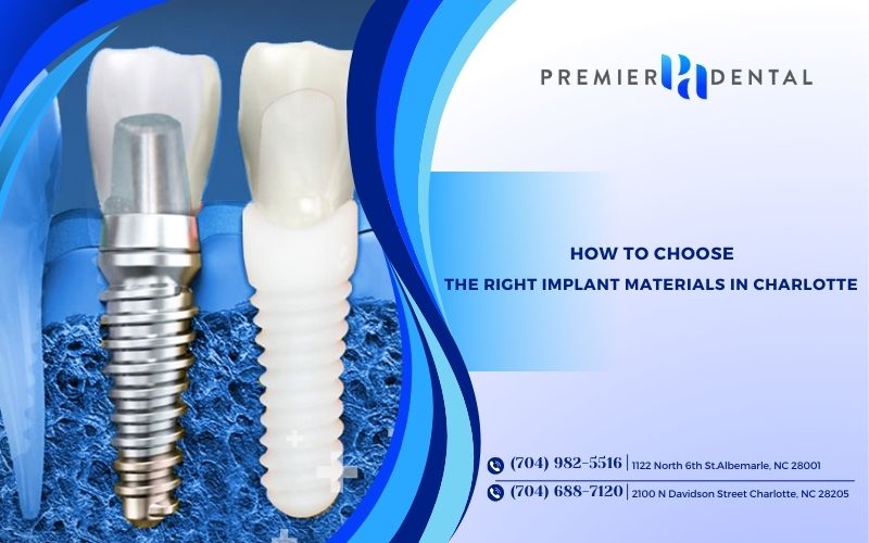 How to Choose the Right Implant Materials in Charlotte for You?