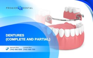 alternatives to dental implants in CharlotteDentures (Complete and Partial)