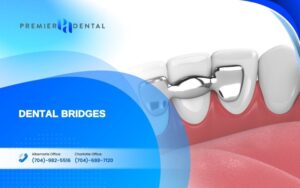 alternatives to dental implants in CharlotteDental bridges