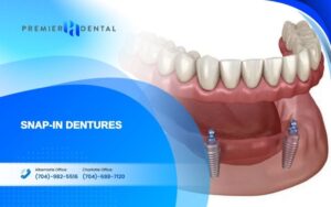 alternatives to dental implants in CharlotteSnap-In Dentures