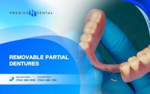 alternatives to dental implants in CharlotteRemovable Partial Dentures