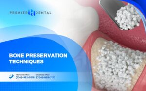 alternatives to dental implants in CharlotteBone Preservation Techniques