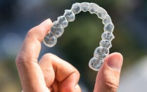 Factors Affecting Invisalign Costs