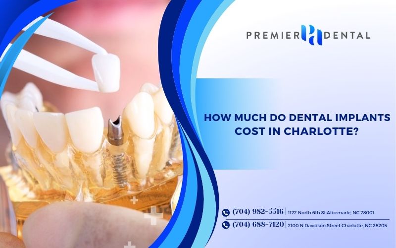 How Much Do Dental Implants Cost in Charlotte?