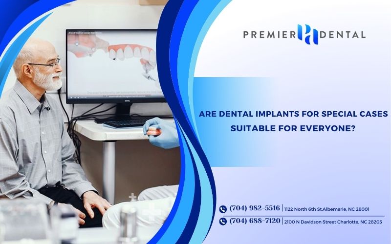 Are Dental Implants for Special Cases Suitable for Everyone?