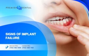 Post-Transplant CareSigns of Implant Failure