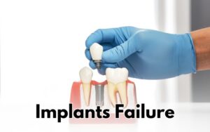 Risks and Complications in CharlotteImplant Failure