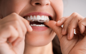 Common Issues and Solutions for Invisalign in CharlotteAligners Not Fitting Properly