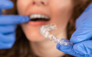 Common Issues and Solutions for Invisalign in CharlotteAllergies to Invisalign Material
