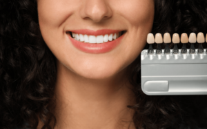 Cosmetic veneer procedure