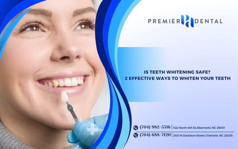 Dental Veneers in Charlotte: Porcelain vs Composite Guide