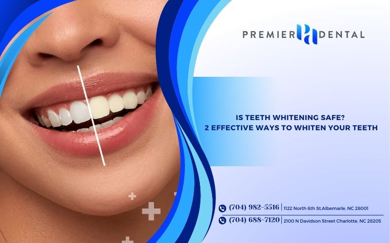 Is Teeth Whitening Safe? 2 Effective Ways to Whiten Your Teeth
