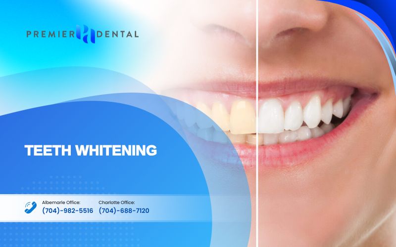cosmetic dentistryTeeth Whitening