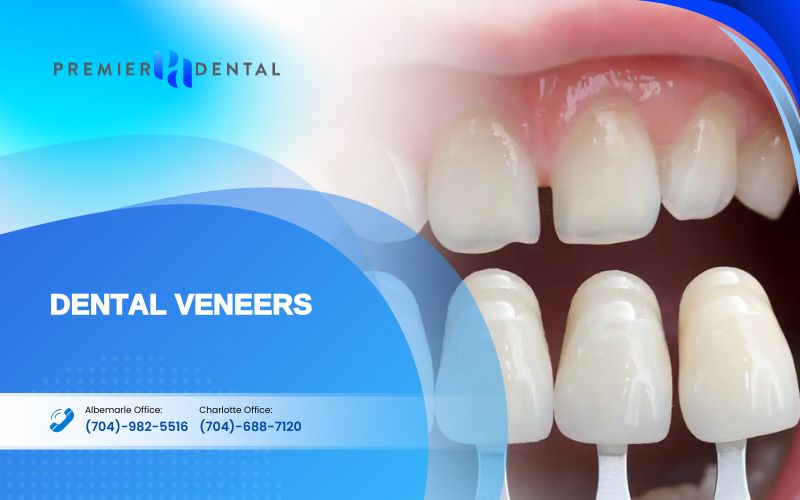 cosmetic dentistryDental Veneers