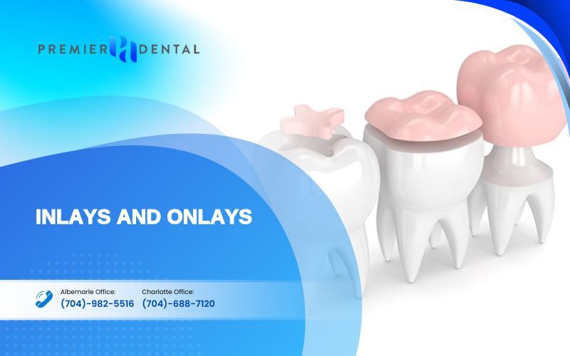 cosmetic dentistryInlays and Onlays